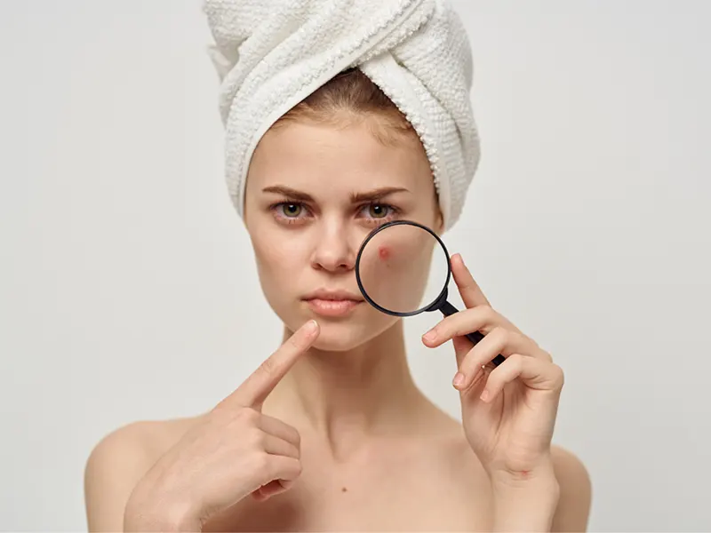 Can Skin Cycling Cause Purging?