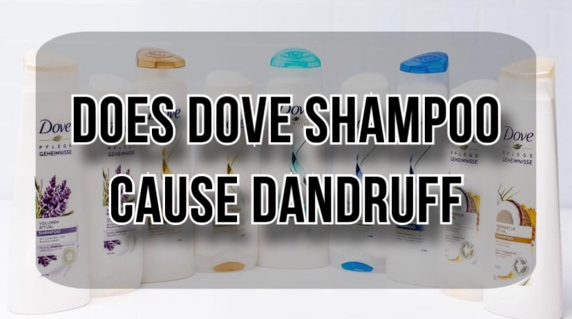 Does Dove Shampoo Cause Dandruff? Effect on Scalp Explained