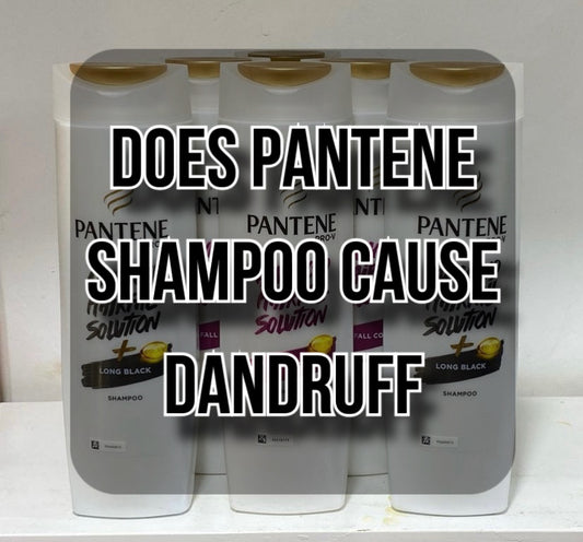 does-pantene-shampoo-cause-dandruff