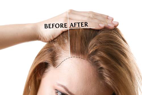 What Causes Frizzy Hair | 7 Common Causes Of Frizz And How To Fix Them